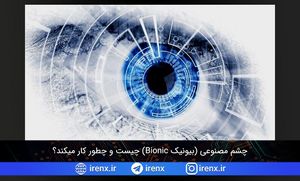 چشم مصنوعی (بیونیک Bionic) چیست و چطور کار میکند؟